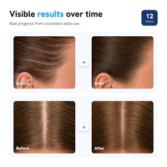 Be Bodywise roll-on held in hand to show scale and easy portable size advantage