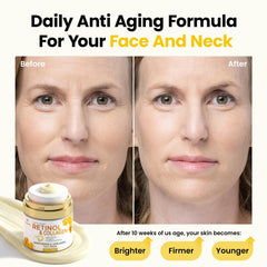 Bealions applied to neck highlighting lifting and smoothing benefit