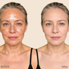 BESHICO split-face before and after showing reduced shine and blurred pores