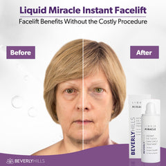 Beverly Hills applying serum under eye demonstrating reduced puffiness