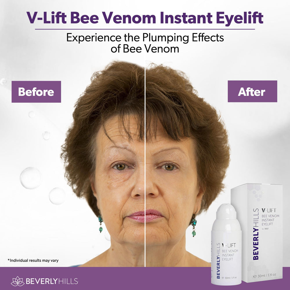 Model applying Beverly Hills V-Lift under eye demonstrating quick-tightening benefit