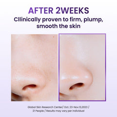 BIOHEAL BOH cream texture on fingertip showing lightweight spreadability benefit