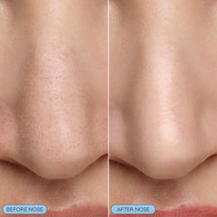Bioré bubbling nose mask on skin demonstrating deep pore cleaning