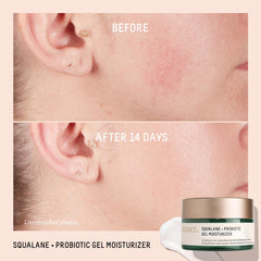 BIOSSANCE bisabolol ingredient close-up emphasizing soothing, redness-reducing comfort