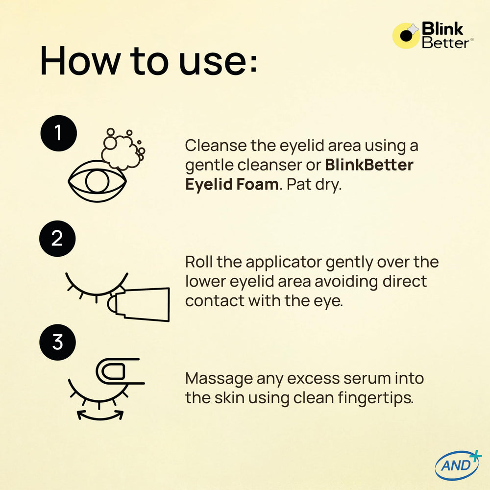 BlinkBetter roller beside travel items illustrating convenient on-the-go relief