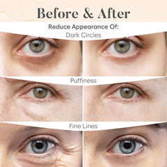 BLOOMORA patch applied under eye demonstrating de-puffing effect