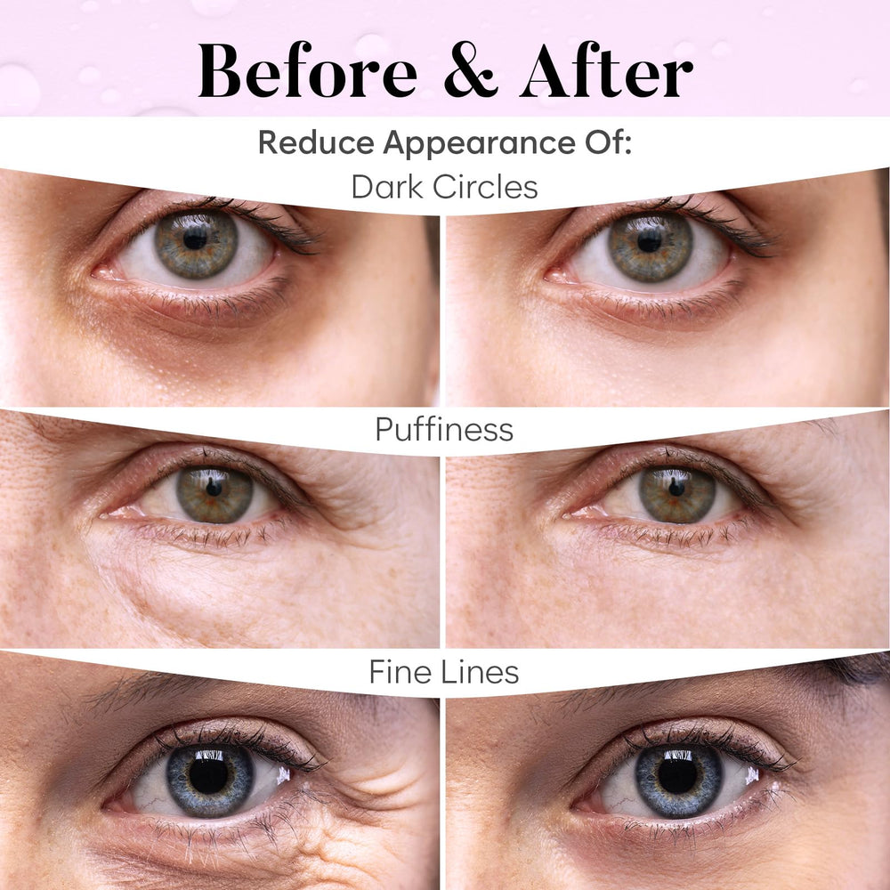 BLOOMORA patch applied under eye showing de-puffing benefit during use