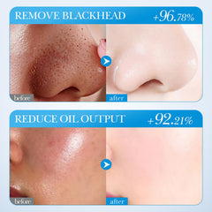 blopuivo turmeric stick applied on T-zone demonstrating deep-cleaning, oil control