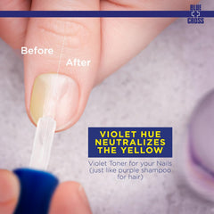Blue Cross before and after nails showing yellow neutralization and brighter nail appearance