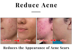 Blusheva Beauty bar in shower scene showing daily face and body use