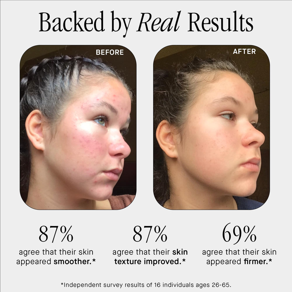 Brandefy serum texture close-up highlighting lightweight, hydrating formula