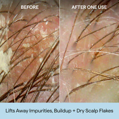 Hand applying Briogeo shampoo to roots for targeted exfoliation