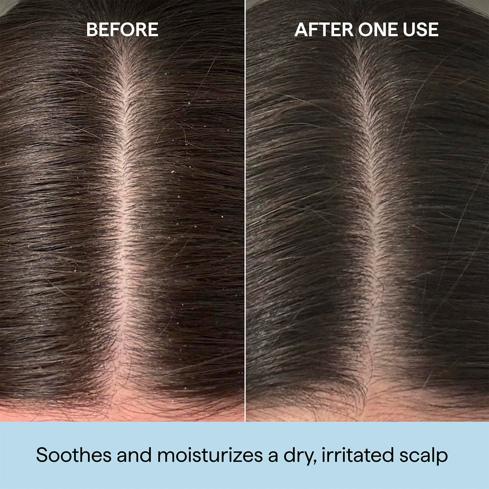 Briogeo oil texture on dropper highlighting lightweight hydration