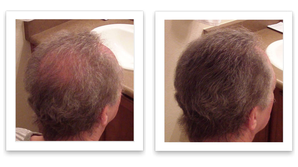 Person using Caboki during morning routine for fast confidence boost