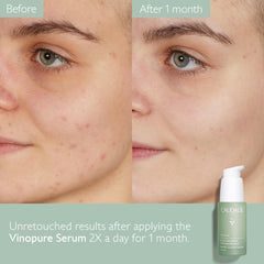 30 mL Vinopure bottle next to common items showing Caudalie travel-friendly size