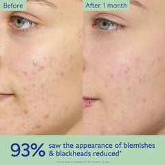 Caudalie Vinopure texture close-up demonstrating lightweight, mattifying finish