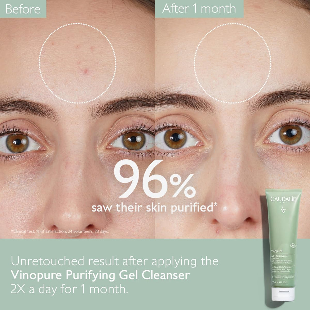 Close-up of Caudalie Vinopure gel texture highlighting gentle exfoliation benefit