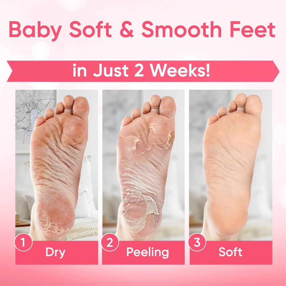 CÉLOR foot in bootie during application for a mess-free treatment