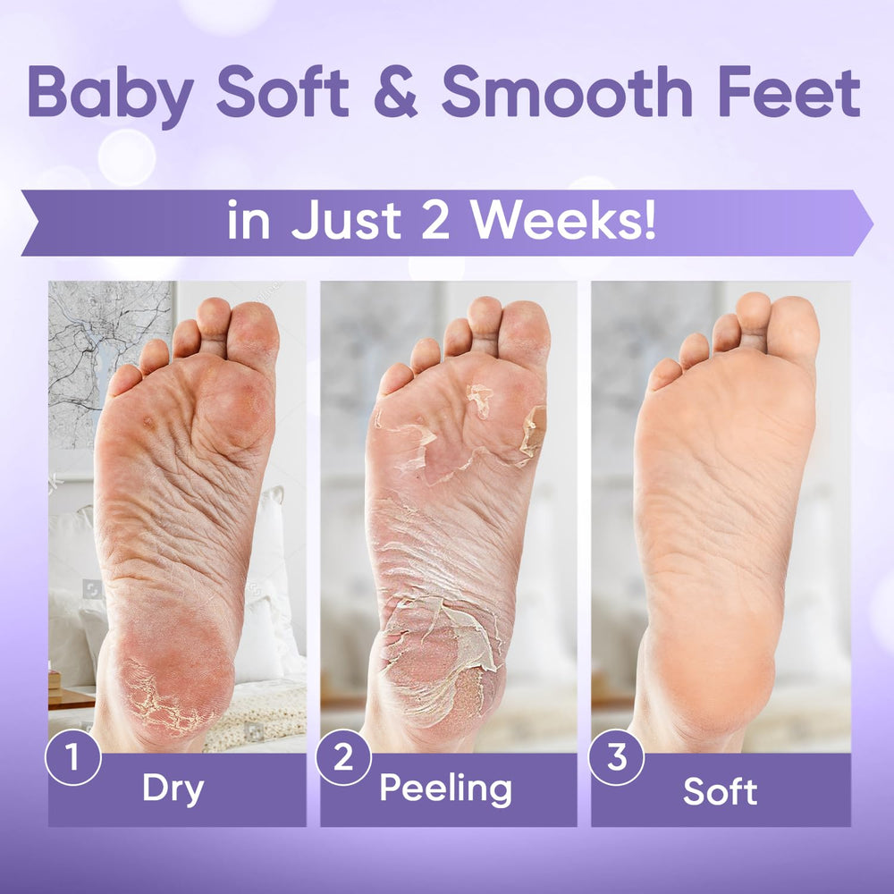 CÉLOR mask in use with booties on foot demonstrating comfortable fit benefit