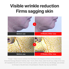 CENTELLIAN 24 application on cheek and forehead showing hydration boost