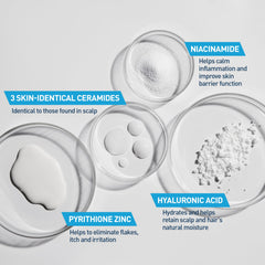 CeraVe before and after scalp showing reduced flakes benefit