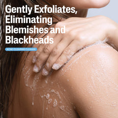 Cetaphil bottle with 2% salicylic acid callout for acne control