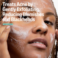 Cetaphil gel texture close-up highlighting creamy foam and gentle exfoliation