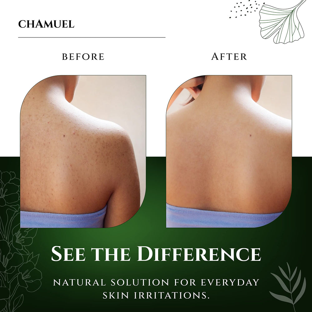 Chamuel gel texture close-up highlighting soothing aloe and oils