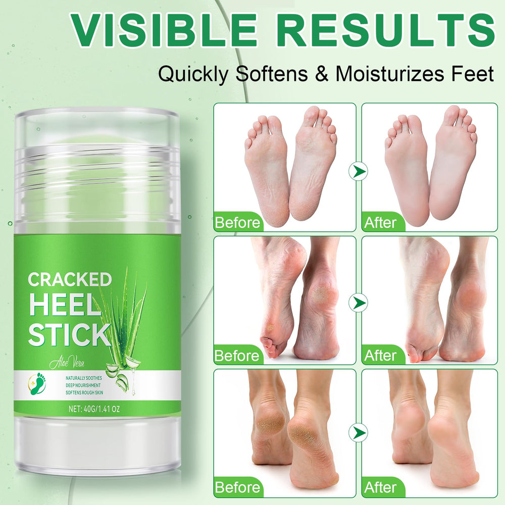 chenyayun applying stick to cracked heel illustrating quick targeted hydration