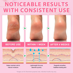 chenyayun applied to heel inside sock showing softening benefit