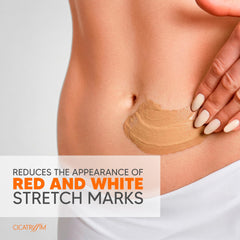 Cicatrissim cream applied to belly demonstrating gentle application