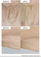 City Beauty open jar texture close-up showing rich balm for instant hydration