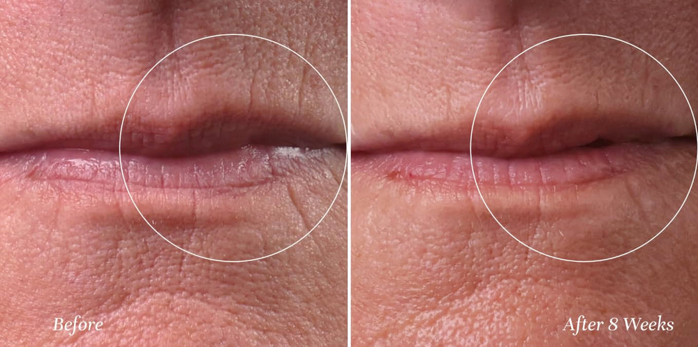 City Beauty Line Therapy close-up of cream texture delivering hydration
