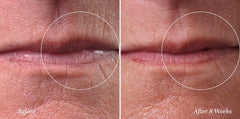 City Beauty Line Therapy close-up of cream texture delivering hydration