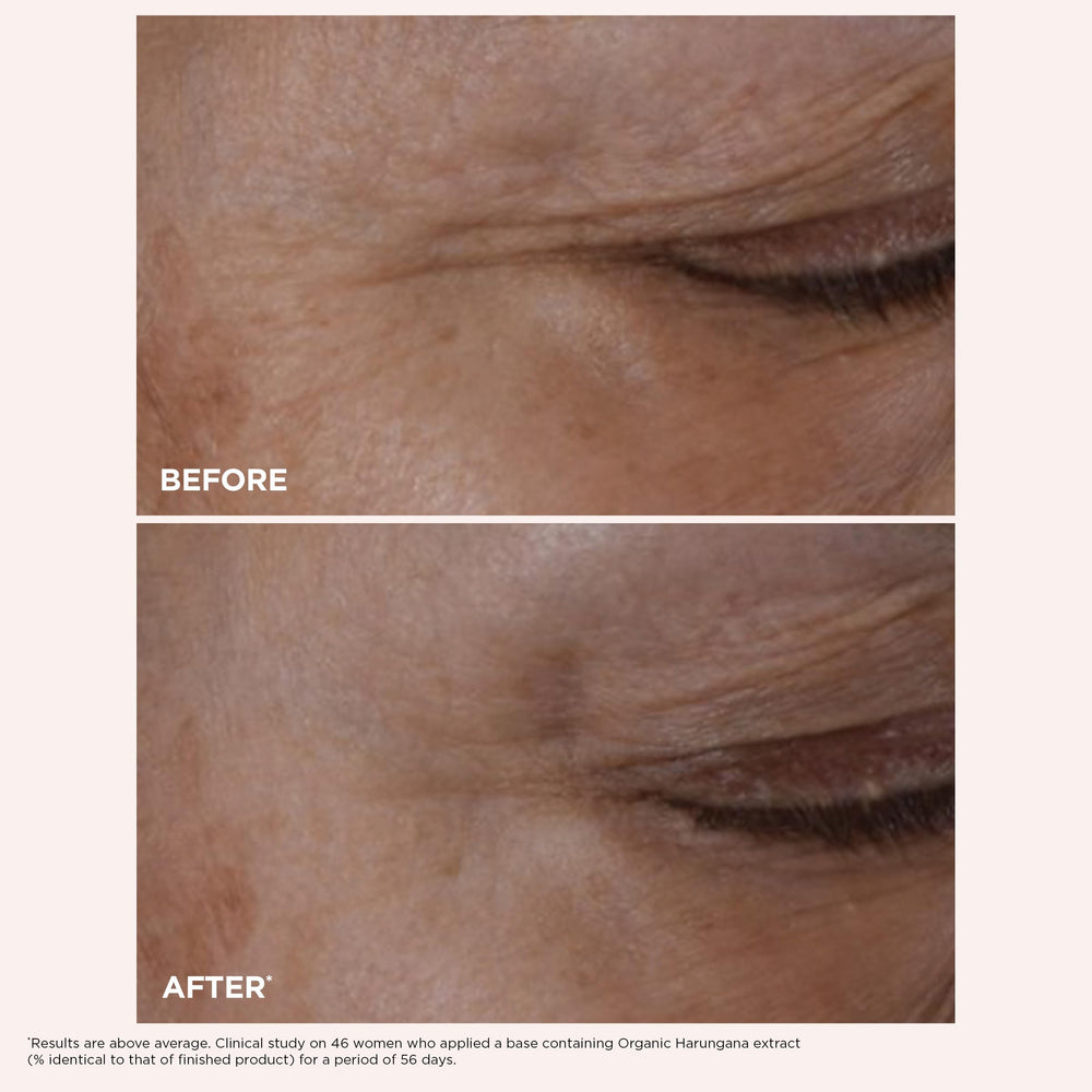 Clarins Total Eye Lift fingertip application showing precise massage benefit