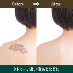 CLASSE applied on arm covering a tattoo to demonstrate invisible concealing effect