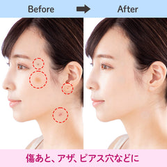CLASSE round-shaped tape on backing, easy press-and-apply concealment benefit