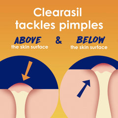 Clearasil pad soaked in solution highlighting salicylic acid treatment