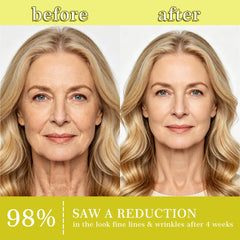 CLERVUN product applied on skin before and after, suggests visible texture improvement