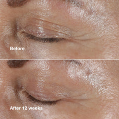 Clinique peptides ingredient visual communicating fortifying benefits for skin