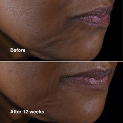 Clinique ingredient visual with hyaluronic acid and peptides for support