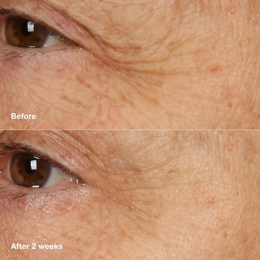 Clinique packaging label detail highlighting peptide and hyaluronic information for clarity