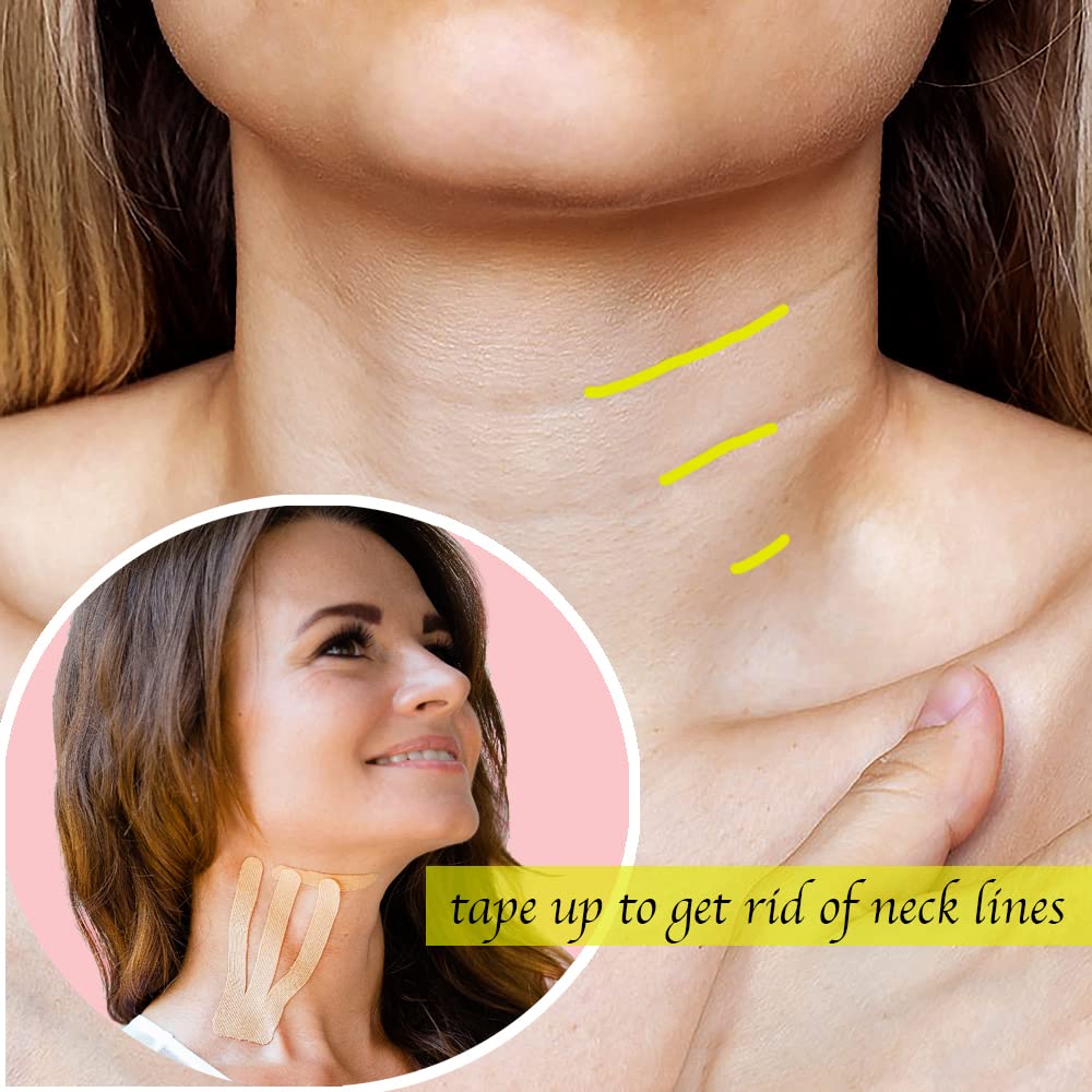 Comfordent tape applied under chin demonstrating V-line lift benefit