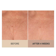 Consult Beaute jar angle showing label details and product benefit clarity