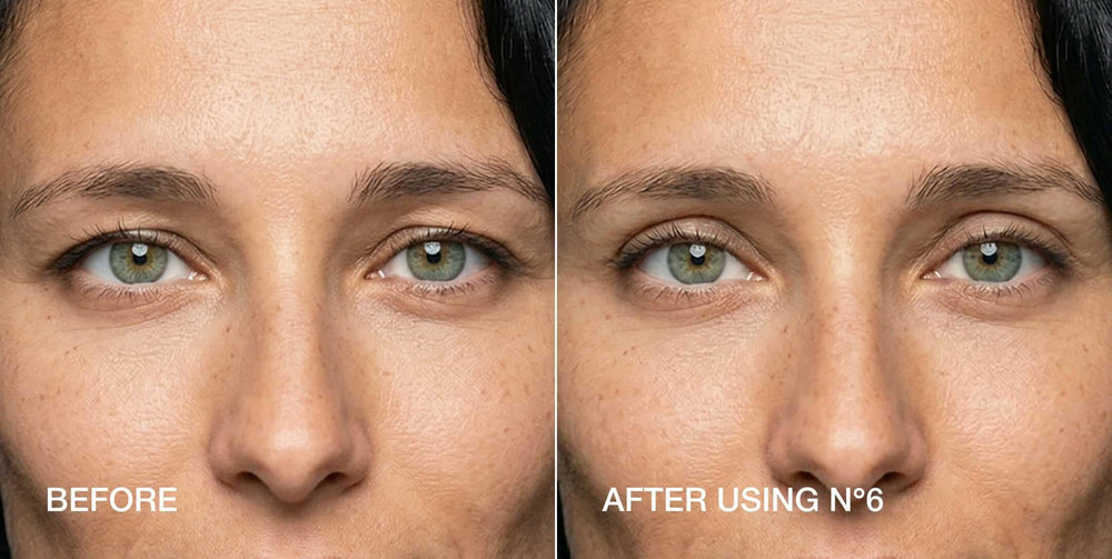 Contours Rx before and after comparison demonstrating visible lift