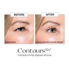 Contours Rx contents with tweezers and strips demonstrating included application tools