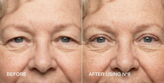 Contours Rx tweezers and strips on sheet for precise placement benefit