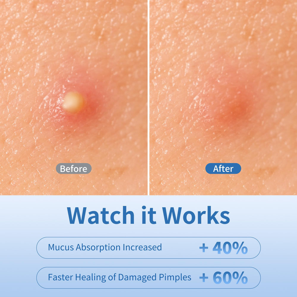 Daolyo star patch on cheek protecting blemish during day