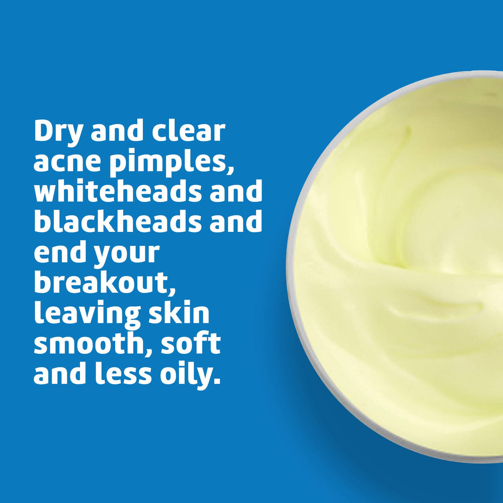 De La Cruz back area treatment showing product use on body acne-prone skin for coverage