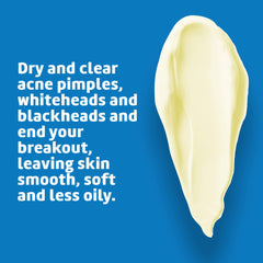 Applying De La Cruz sulfur ointment to facial blemish for targeted reduction benefit